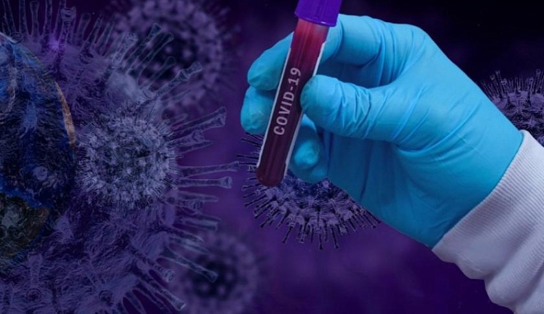 Минздрав Российской Федерации сообщил, что ситуация с COVID-19 в России идет по благоприятному сценарию