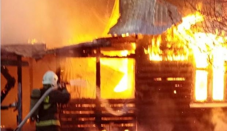 В Калуге во время пожара женщина получила сильные ожоги рук