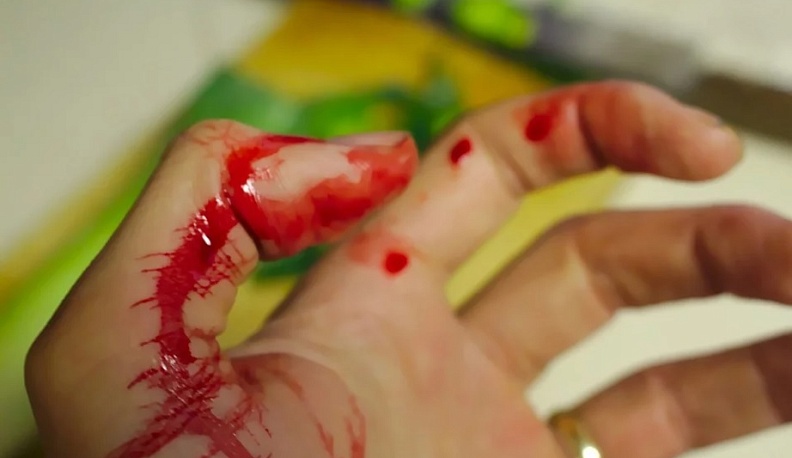 Житель Боровска ударил ножом в грудь своего гостя