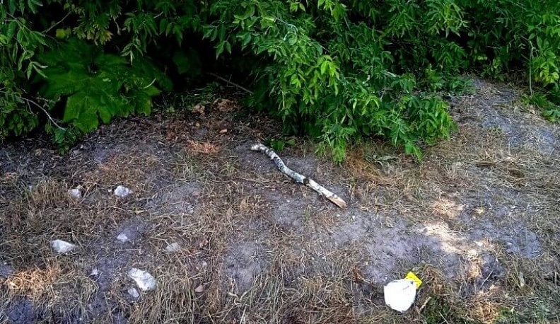 В минздраве рассказали о состоянии ребенка, покусанного собаками в Калужской области