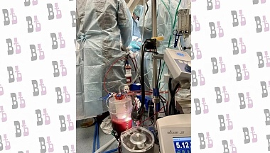 Калужские врачи спасли жизнь пациенту с помощью уникальной технологии