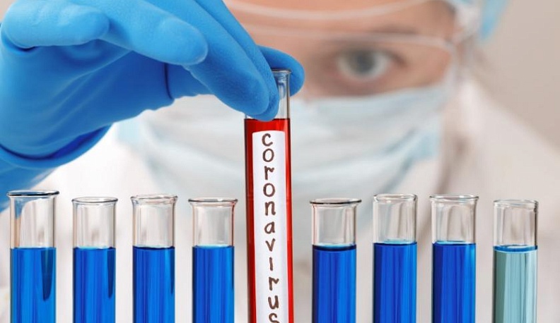 За минувшие сутки в Калуге не зафиксировано ни одного умершего от covid-19 