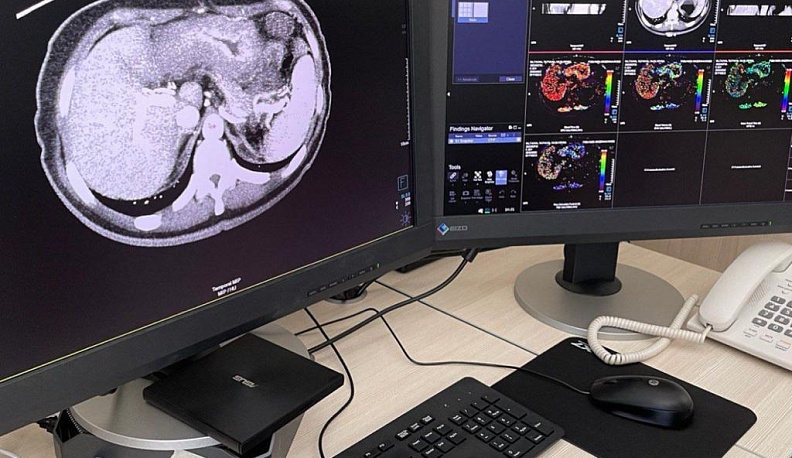 Владислав Шапша рассказал об обновлённом отделении компьютерной томографии в Обнинске 