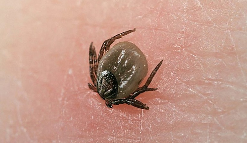 Десять калужан стали первыми жертвами клещей 