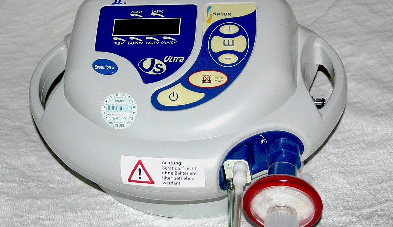 Суд обязал калужский минздрав предоставить девочке аппарат ИВЛ