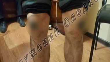 В Медыни осужденный ответит в суде за экстремистские татуировки