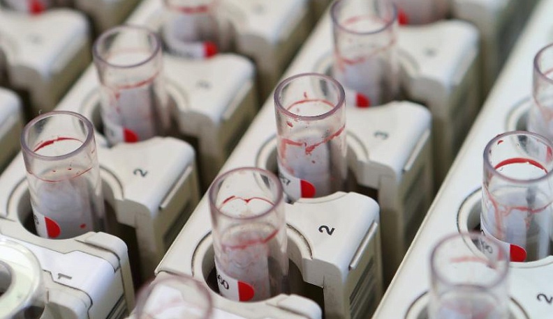 В Калуге экспресс-анализ на ВИЧ можно сделать анонимно